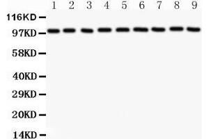 Western Blotting (WB) image for anti-Catenin (Cadherin-Associated Protein), alpha 1, 102kDa (CTNNA1) (AA 143-292) antibody (ABIN3043818)