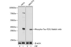 Western blot analysis of extracts of various cell lines, using Phospho-Tau-T231 Rabbit mAb (ABIN7268531) at 1:1000 dilution. (MAPT Antikörper  (pThr231))