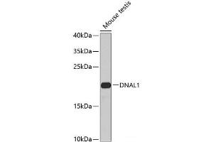 Western blot analysis of extracts of Mouse testis using DNAL1 Polyclonal Antibody at dilution of 1:1000. (DNAL1 Antikörper)