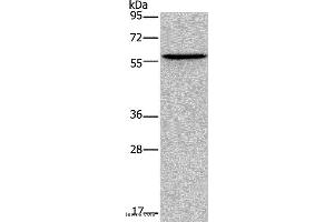 Western blot analysis of Human lung cancer tissue, using ADRA1B Polyclonal Antibody at dilution of 1:550 (ADRA1B Antikörper)