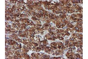 Image no. 8 for anti-Protein Disulfide Isomerase Family A, Member 4 (PDIA4) antibody (ABIN1500110)