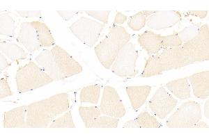 Detection of CCDC80 in Human Skeletal muscle Tissue using Polyclonal Antibody to Coiled Coil Domain Containing Protein 80 (CCDC80) (CCDC80 Antikörper  (AA 81-258))