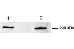 Western Blotting (WB) image for anti-Myoferlin (MYOF) antibody (ABIN1108357)