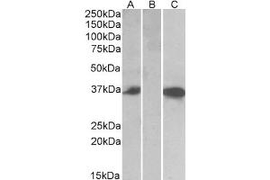 HEK293 lysate (10ug protein in RIPA buffer) over expressing Human CMA1 with DYKDDDDK tag probed with ABIN768626 (0.