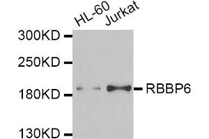 Western blot analysis of extracts of various cell lines, using RBBP6 antibody (ABIN5974190) at 1/1000 dilution.