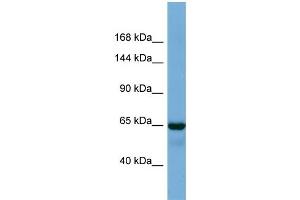 Host:  Rabbit  Target Name:  DKFZp686A1782  Sample Type:  Fetal Lung lysates  Antibody Dilution:  1.