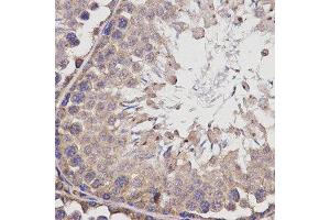 Immunohistochemistry (IHC) image for anti-Butyrylcholinesterase (BCHE) antibody (ABIN1871242) (Butyrylcholinesterase Antikörper)
