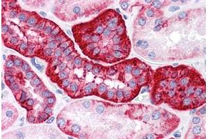 Human Kidney: Formalin-Fixed, Paraffin-Embedded (FFPE) (EpCAM Antikörper)