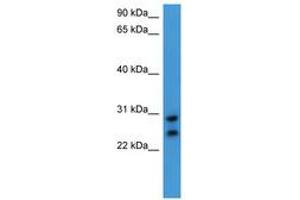Image no. 1 for anti-Carcinoembryonic Antigen-Related Cell Adhesion Molecule 7 (CEACAM7) (AA 142-191) antibody (ABIN6746761) (CEACAM7 Antikörper  (AA 142-191))
