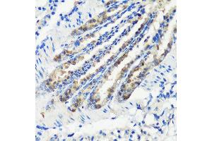 Immunohistochemistry of paraffin-embedded mouse lung using KMT2E antibody (ABIN6131786, ABIN6142983, ABIN6142984 and ABIN6221745) at dilution of 1:200 (40x lens). (MLL5/KMT2E Antikörper  (AA 200-500))