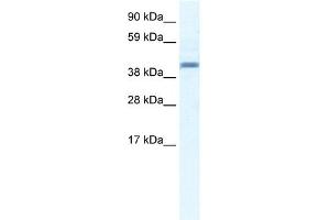WB Suggested Anti-ANXA7 Antibody Titration:  2. (Annexin VII Antikörper  (N-Term))
