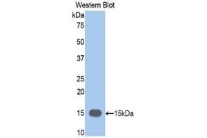 Western blot analysis of the recombinant protein. (MMP12 Antikörper  (AA 270-362))