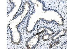 IHC analysis of LPP using anti LPP antibody (ABIN7602831). (LPP Antikörper  (C-Term))