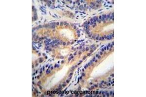 Immunohistochemistry (IHC) image for anti-Hydroxysteroid (11-Beta) Dehydrogenase 1-Like (HSD11B1L) antibody (ABIN2996215) (HSD11B1L Antikörper)