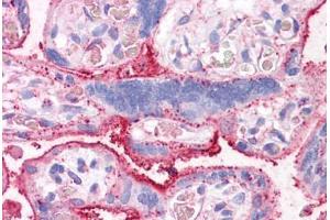 Anti-CTR1 antibody  ABIN960806 IHC staining of human placenta. (SLC31A1 Antikörper  (Internal Region))