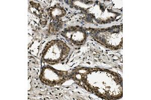 IHC analysis of RPA32/RPA2 using anti-RPA32/RPA2 antibody (ABIN7601380). (RPA2 Antikörper  (AA 34-254))