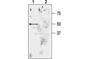 Western blot analysis of rat cerebellum lysate: - 1. (KCNK9 Antikörper  (Extracellular, P1 Loop))