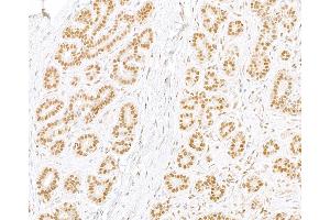 Immunohistochemistry (IHC) image for anti-Replication Protein A2, 32kDa (RPA2) (C-Term) antibody (ABIN7454599) (RPA2 Antikörper  (C-Term))