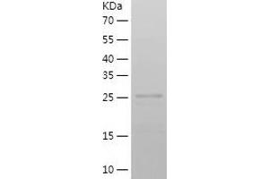 Western Blotting (WB) image for gamma-Glutamyl Hydrolase (Conjugase, Folylpolygammaglutamyl Hydrolase) (GGH) (AA 25-318) protein (His-IF2DI Tag) (ABIN7123051)