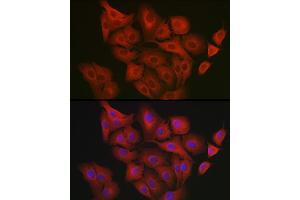 Immunofluorescence analysis of  cells using GART Rabbit pAb (ABIN1679954, ABIN3018225, ABIN3018226 and ABIN6220407) at dilution of 1:200 (40x lens). (GART Antikörper  (AA 1-320))
