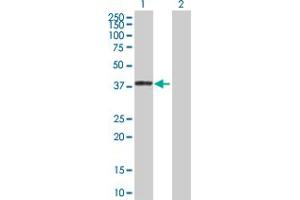 Western Blot analysis of TNK2 expression in transfected 293T cell line by TNK2 MaxPab polyclonal antibody. (TNK2 Antikörper  (AA 1-352))