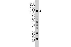 The UBA1 polyclonal antibody  is used in Western blot to detect UBA1 in HL-60 cell lysate. (UBA1 Antikörper  (C-Term))