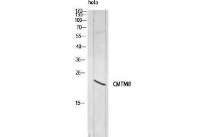 Western Blot (WB) analysis of HeLa lysis using CMTM8 antibody. (CMTM8 Antikörper)