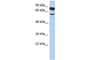 WB Suggested Anti-DPY19L4 Antibody Titration: 0. (DPY19L4 Antikörper  (Middle Region))