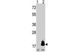 Western blot analysis of EIF4EBP1 (arrow) using rabbit EIF4EBP1 polyclonal antibody . (eIF4EBP1 Antikörper  (Thr69))