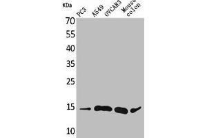 Western Blot analysis of PC-3 A549 OVCAR3 mouse colon cells using Eotaxin-3 Polyclonal Antibody (CCL26 Antikörper  (Internal Region))