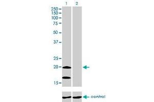 Western Blotting (WB) image for anti-NADH Dehydrogenase (Ubiquinone) Fe-S Protein 4, 18kDa (NADH-Coenzyme Q Reductase) (NDUFS4) (AA 66-176) antibody (ABIN598831) (NDUFS4 Antikörper  (AA 66-176))