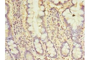 Immunohistochemistry of paraffin-embedded human small intestine tissue using ABIN7146141 at dilution of 1:100 (CXCL6 Antikörper  (AA 38-114))