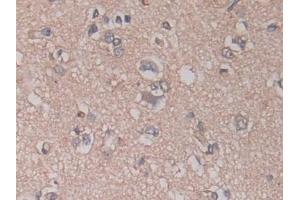 Immunohistochemistry (IHC) image for anti-ADAM Metallopeptidase Domain 17 (ADAM17) (AA 226-473) antibody (ABIN7426310)