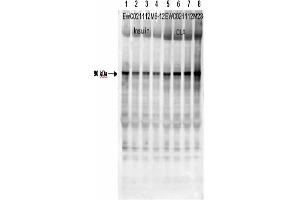 Affinity Purified Phospho-specific antibody to human muscle Glycogen Synthase (GS) at pS640 was used at a 1:1000 dilution to detect human muscle GS by Western blot. (Glycogen Synthase 1 Antikörper  (pSer640))