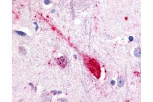 Immunohistochemical staining of Putamen (Neuron) using anti- GPR85 antibody ABIN122575 (GPR85 Antikörper)