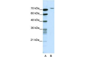 WB Suggested Anti-TAF6 Antibody Titration:  2. (TAF6 Antikörper  (N-Term))