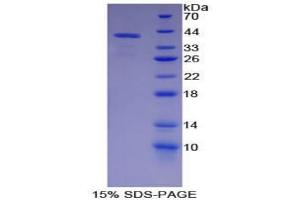 SDS-PAGE analysis of Pig Parathyroid Hormone Protein. (PTH Protein)