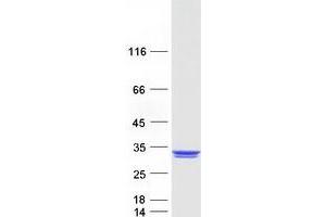 Validation with Western Blot