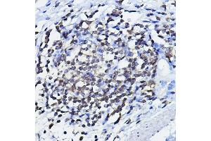 Immunohistochemistry of paraffin-embedded human lymph node using TP73 Rabbit pAb (ABIN6133470, ABIN6149430, ABIN6149431 and ABIN6213831) at dilution of 1:100 (40x lens). (Tumor Protein p73 Antikörper  (AA 1-100))