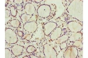 Immunohistochemistry of paraffin-embedded human thyroid tissue using ABIN7168238 at dilution of 1:100