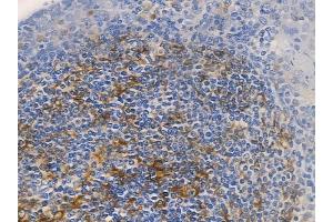 ABIN6259414 and ABIN6276188 at 1/100 staining human normal tonsil tissue by IHC-P.