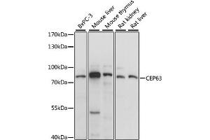 Western blot analysis of extracts of various cell lines, using CEP63 antibody (ABIN7266278) at 1:1000 dilution. (CEP63 Antikörper  (AA 1-300))