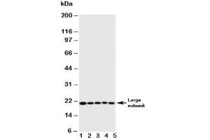 Western blot testing of Caspase-4 antibody and Lane 1:  MCF-7 (Caspase 4 Antikörper  (AA 104-124))