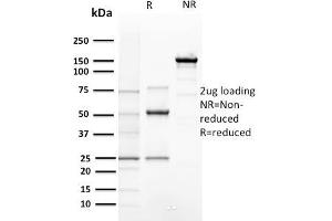 SDS-PAGE Analysis of Purified Cyclin E1 Mouse Recombinant Monoclonal Antibody ABIN6383795.