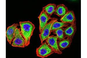 Immunocytochemistry (ICC) image for anti-Proteasome (Prosome, Macropain) 26S Subunit, ATPase, 3 (PSMC3) (AA 53-152) antibody (ABIN5542634)