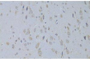 Immunohistochemistry of paraffin-embedded Rat brain using IGF2 Polyclonal Antibody at dilution of 1:100 (40x lens). (IGF2 Antikörper)