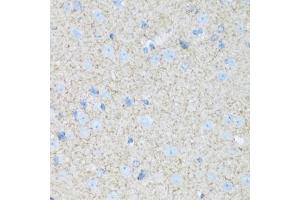 Immunohistochemistry of paraffin-embedded mouse brain using B2 antibody (ABIN7265773) at dilution of 1:100 (40x lens).