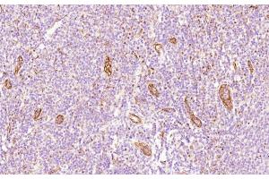 Immunohistochemical analysis of paraffin-embedded Human tonsil section using Pink1 (ABIN658983 and ABIN2838032). (CD34 Antikörper  (AA 185-214))