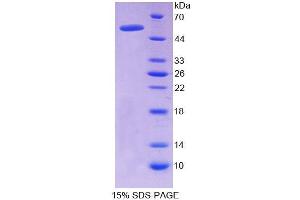 SDS-PAGE (SDS) image for Nuclear Receptor Subfamily 1, Group H, Member 4 (NR1H4) protein (ABIN6019849)