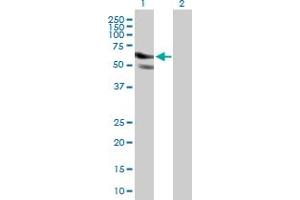 Western Blot analysis of GPATCH2 expression in transfected 293T cell line by GPATCH2 MaxPab polyclonal antibody. (GPATCH2 Antikörper  (AA 1-376))